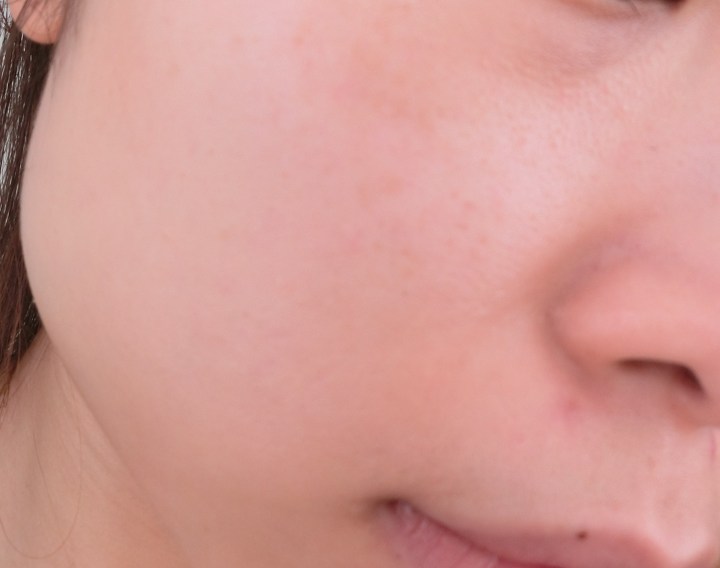 bliss-firm-baby-firm-skin-close-up